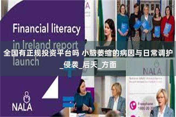 全国有正规投资平台吗 小脑萎缩的病因与日常调护_侵袭_后天_方面